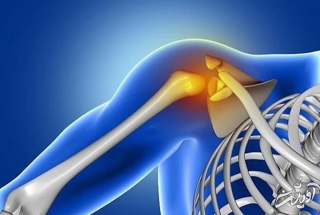 علت و علائم شانه یخ زده سندرم شانه یخ زده